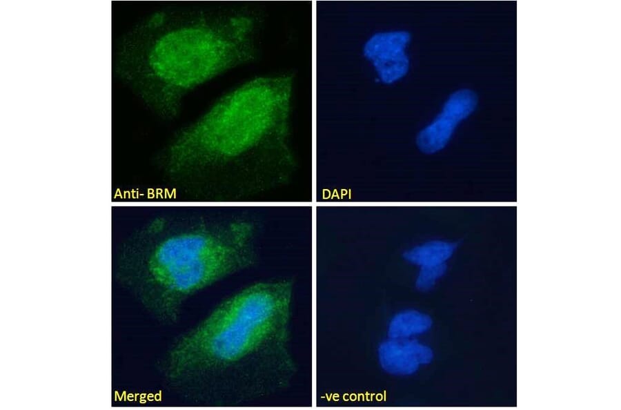 Immunofluorescence - Anti-BRM Antibody (A121174) - Antibodies.com