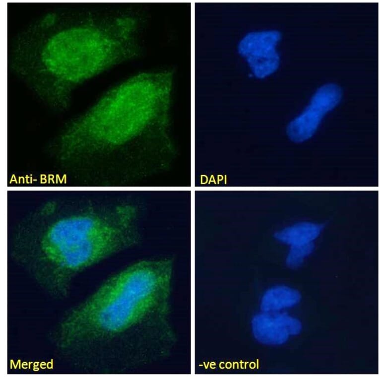 Immunofluorescence - Anti-BRM Antibody (A121174) - Antibodies.com