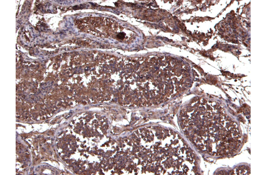 Immunohistochemistry - Anti-LIF Antibody (A121175) - Antibodies.com