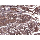 Immunohistochemistry - Anti-LIF Antibody (A121175) - Antibodies.com