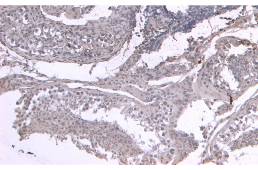 Immunohistochemistry - Anti-LIF Antibody (A121175) - Antibodies.com