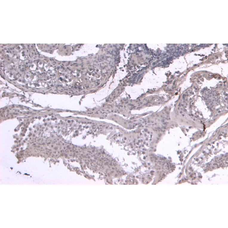 Immunohistochemistry - Anti-LIF Antibody (A121175) - Antibodies.com