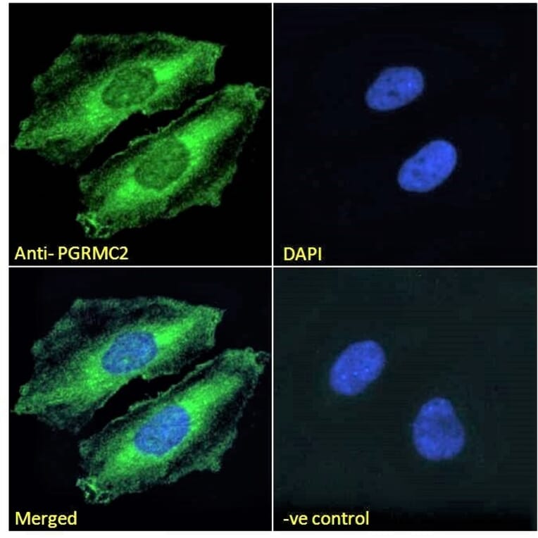 Immunofluorescence - Anti-PGRMC2 Antibody (A121176) - Antibodies.com