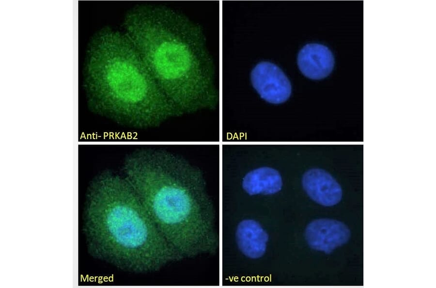 Immunofluorescence - Anti-AMPK beta 2/PRKAB2 Antibody (A121178) - Antibodies.com