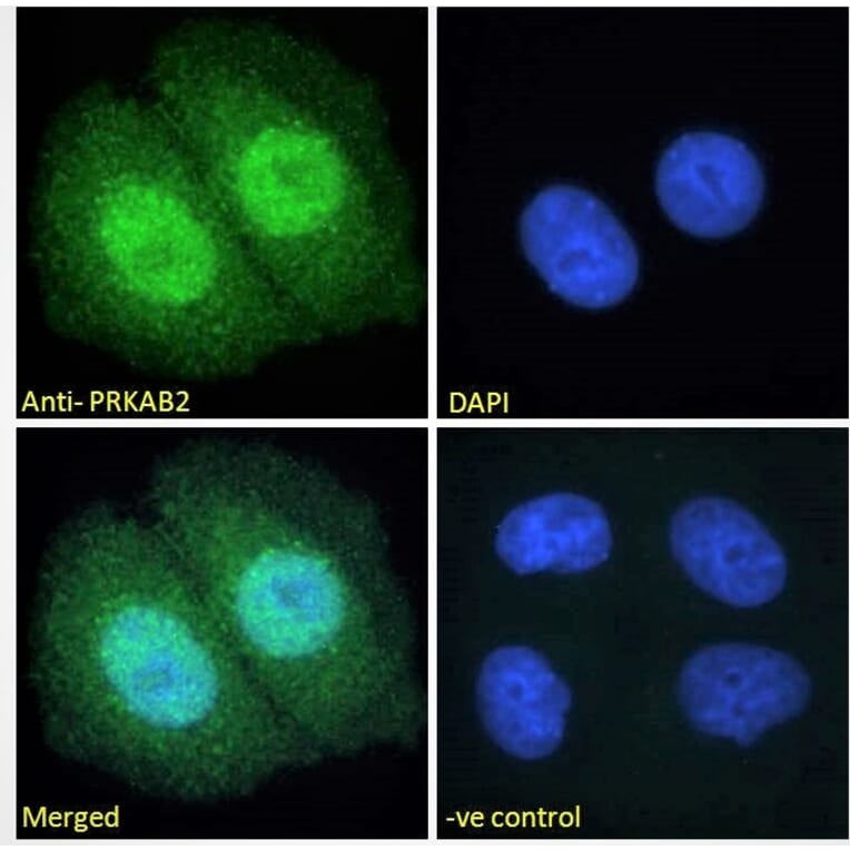 Immunofluorescence - Anti-AMPK beta 2/PRKAB2 Antibody (A121178) - Antibodies.com