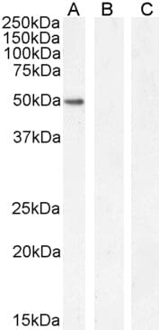 Anti-GATA1 Antibody (A121166) (2µg/ml) staining of K562 nuclear cell lysate (A) + peptide (B) and negative control Human Hippocampus (C) lysate (35µg protein in RIPA buffer). Detected by chemiluminescence.