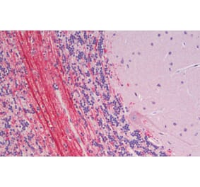 Immunohistochemistry - Anti-Robo3 Antibody (A121179) - Antibodies.com