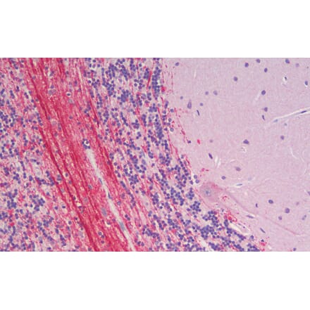 Immunohistochemistry - Anti-Robo3 Antibody (A121179) - Antibodies.com