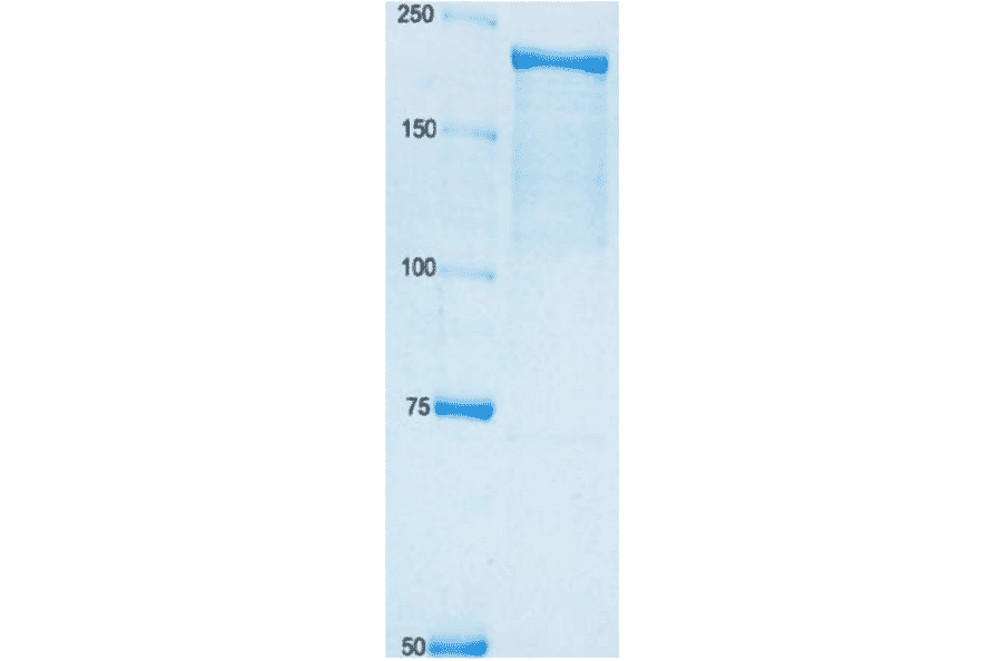 SDS polyacrylamide gel electrophoresis of adenylate cyclase toxin. 8% gel.. Left lane,is size maker proteins shown in kDa.
