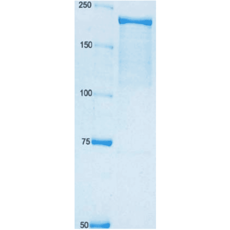 SDS polyacrylamide gel electrophoresis of adenylate cyclase toxin. 8% gel.. Left lane,is size maker proteins shown in kDa.