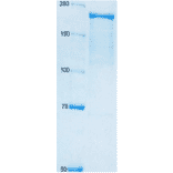 SDS polyacrylamide gel electrophoresis of adenylate cyclase toxin. 8% gel.. Left lane,is size maker proteins shown in kDa.