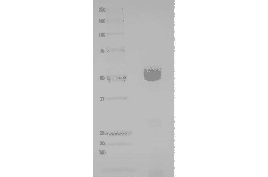Validation Data - Native Diphtheria Toxin Mutant CRM197 (Functional) (Non-Toxic) (A121184)
