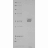 Validation Data - Native Diphtheria Toxin Mutant CRM197 (Functional) (Non-Toxic) (A121184)