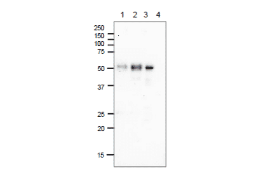 Immunoprecipitationm of E. coli Photolyase.