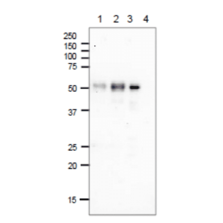 Immunoprecipitationm of E. coli Photolyase.