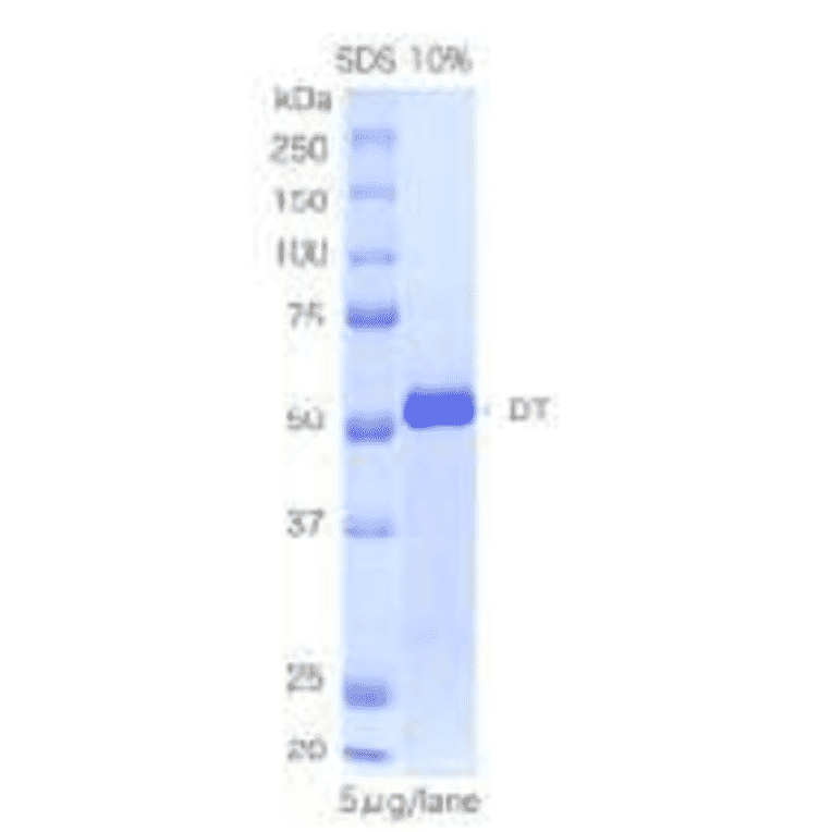 SDS-PAGE of Diphtheria toxin.