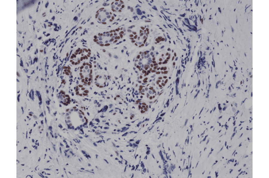 Immunohistochemistry - Anti-STAT3 (phospho Tyr705) Antibody [RM261] (A121239) - Antibodies.com