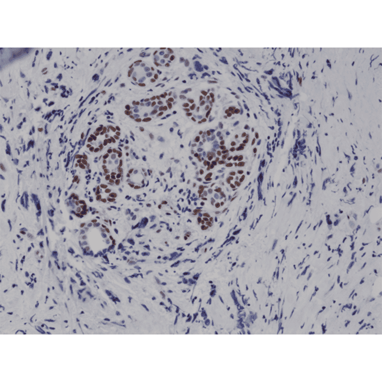 Immunohistochemistry - Anti-STAT3 (phospho Tyr705) Antibody [RM261] (A121239) - Antibodies.com