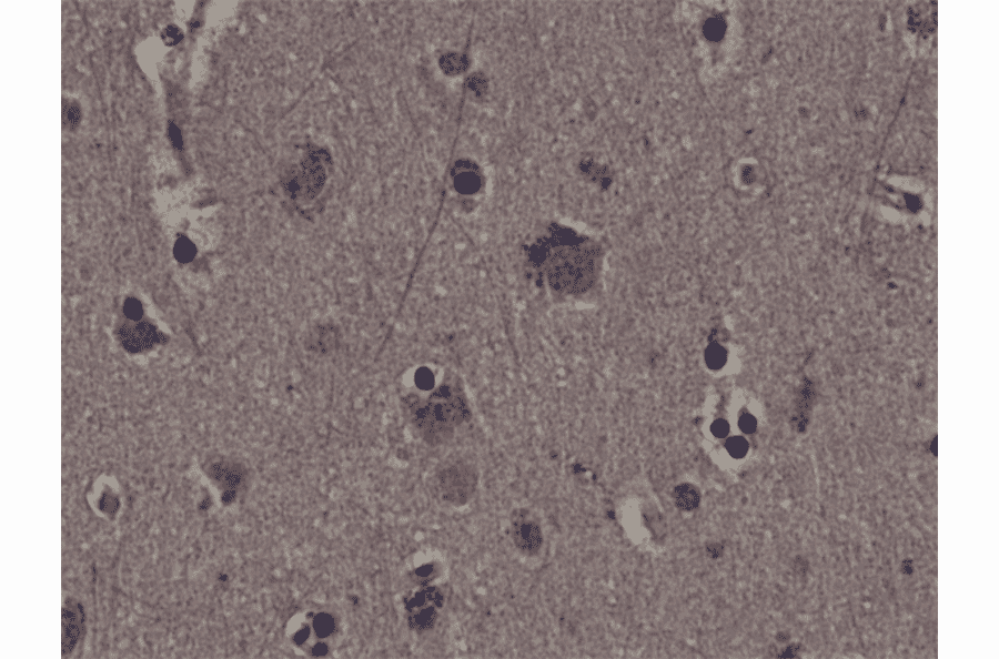 Immunohistochemistry - Anti-RSK1 (phospho Thr359 + Ser363) Antibody [RM233] (A121395) - Antibodies.com