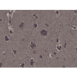 Immunohistochemistry - Anti-RSK1 (phospho Thr359 + Ser363) Antibody [RM233] (A121395) - Antibodies.com