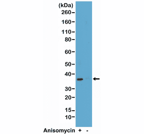 Western Blot - Anti-p38 MAPK (phospho Thr180 + Tyr182) Antibody [RM243] (A121194) - Antibodies.com