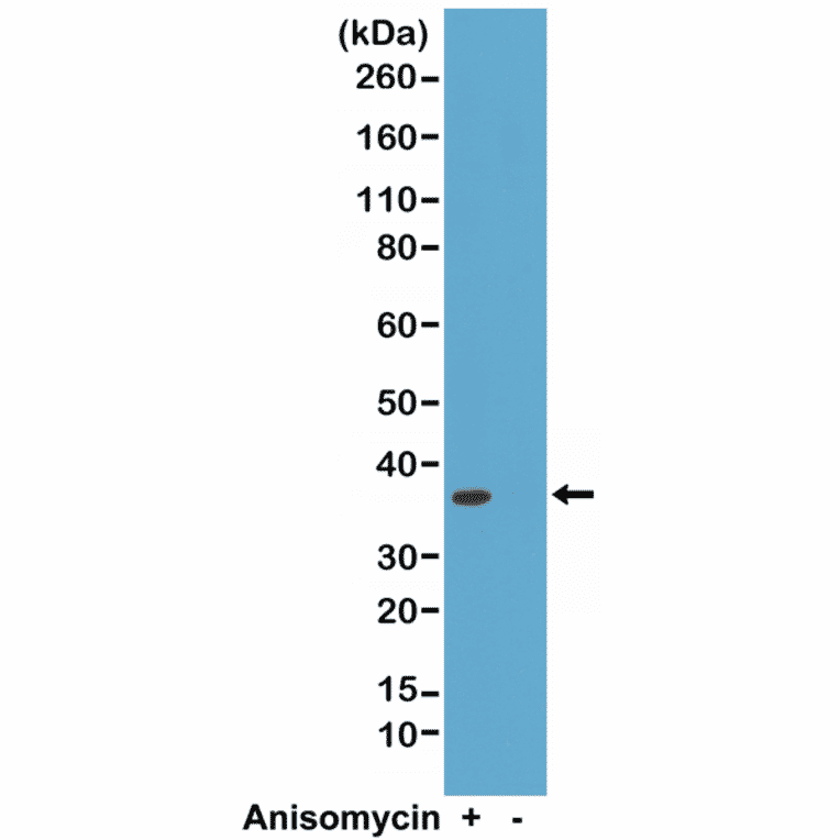 Western Blot - Anti-p38 MAPK (phospho Thr180 + Tyr182) Antibody [RM243] (A121194) - Antibodies.com