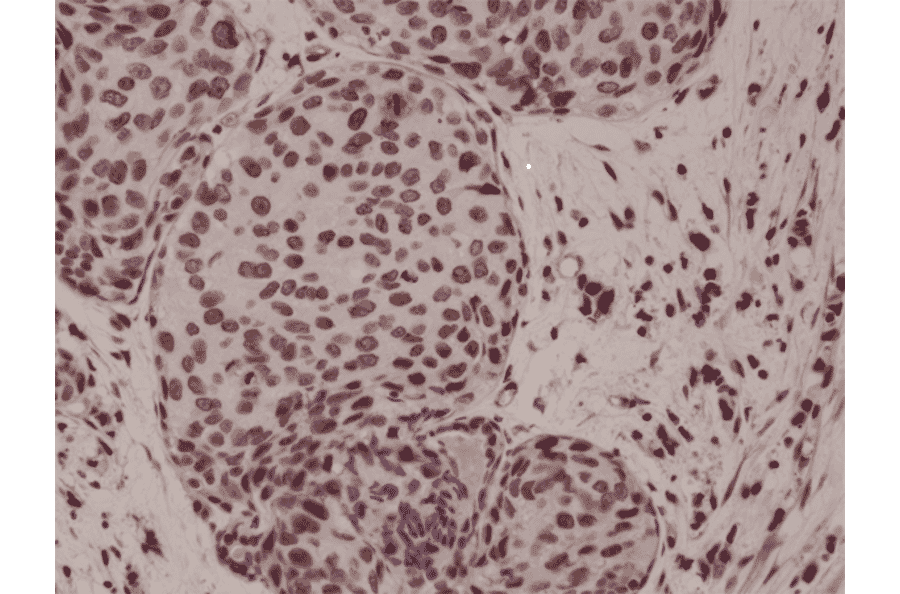 Immunohistochemistry - Anti-p38 MAPK (phospho Thr180 + Tyr182) Antibody [RM243] (A121399) - Antibodies.com