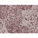 Immunohistochemistry - Anti-p38 MAPK (phospho Thr180 + Tyr182) Antibody [RM243] (A121399) - Antibodies.com