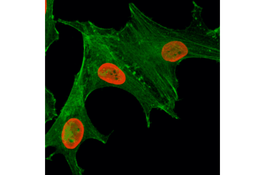 Immunocytochemistry - Anti-Histone H4 (acetyl Lys5) Antibody [RM199] (A121197) - Antibodies.com