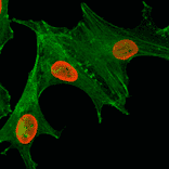 Immunocytochemistry - Anti-Histone H4 (acetyl Lys5) Antibody [RM199] (A121197) - Antibodies.com