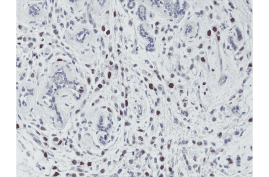 Immunohistochemistry - Anti-Histone H3 (phospho Thr3) Antibody [RM159] (A121211) - Antibodies.com