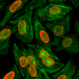 Immunocytochemistry - Anti-Histone H3 (di methyl Lys9) Antibody [RM151] (A121219) - Antibodies.com