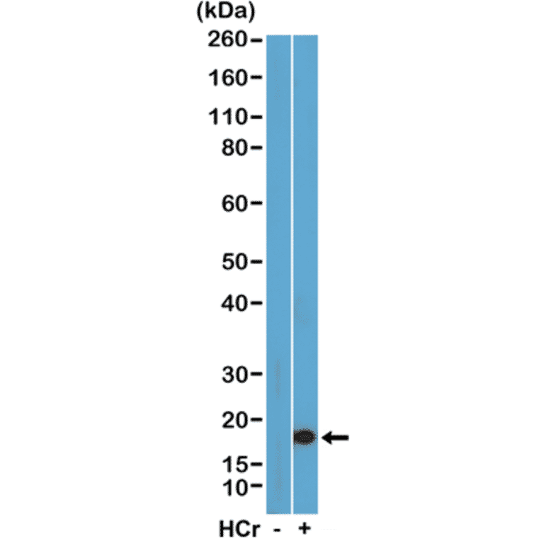 Western Blot - Anti-Histone H3 (crotonyl Lys27) Antibody [RM401] (A121228) - Antibodies.com