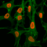 Immunocytochemistry - Anti-Histone H3 (acetyl Lys56) Antibody [RM179] (A121224) - Antibodies.com