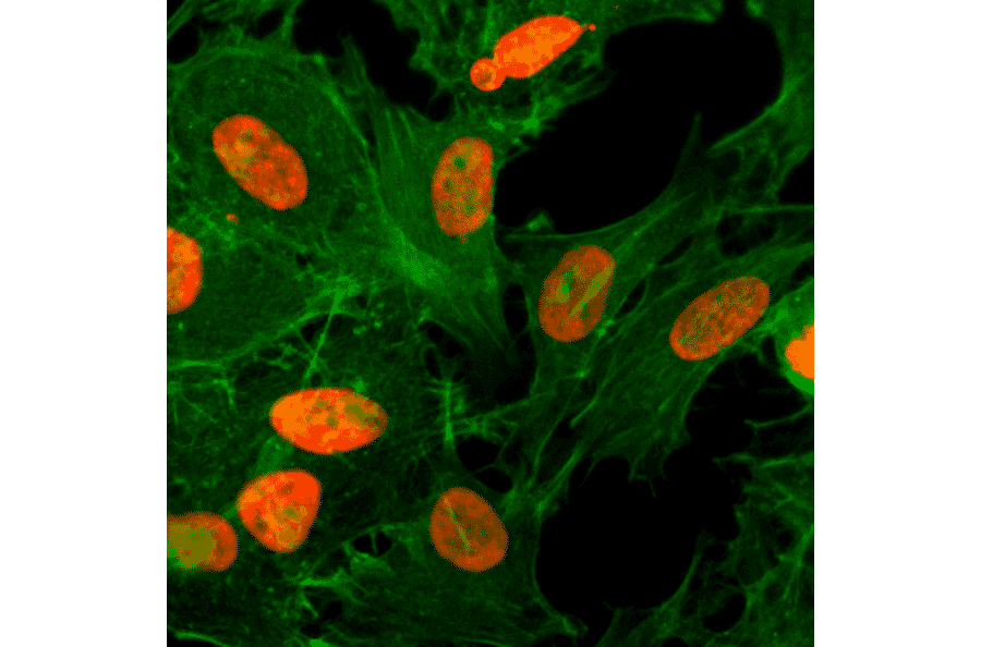 Immunocytochemistry - Anti-Histone H3 (acetyl Lys36) Antibody [RM154] (A121215) - Antibodies.com