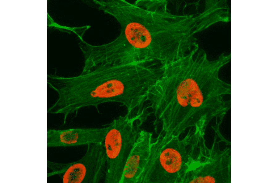 Immunocytochemistry - Anti-Histone H3 (acetyl Lys27) Antibody [RM172] (A121236) - Antibodies.com
