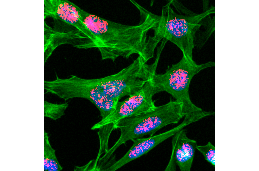 Immunocytochemistry - Anti-Histone H3 (acetyl Lys23) Antibody [RM169] (A121358) - Antibodies.com