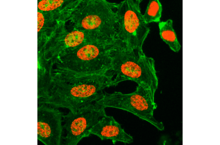 Immunocytochemistry - Anti-Histone H3 (acetyl Lys18) Antibody [RM166] (A121236) - Antibodies.com
