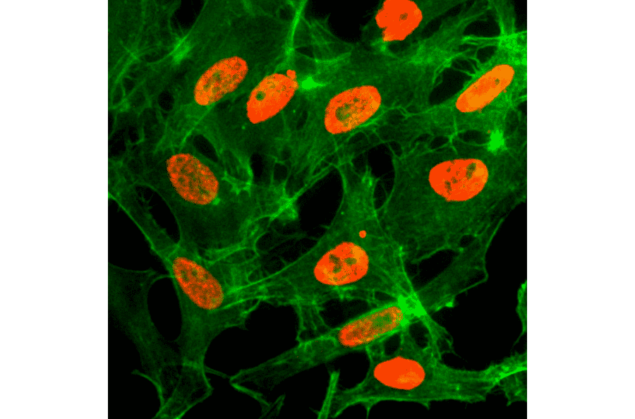 Immunocytochemistry - Anti-Histone H3 (acetyl Lys14) Antibody [RM130] (A121237) - Antibodies.com