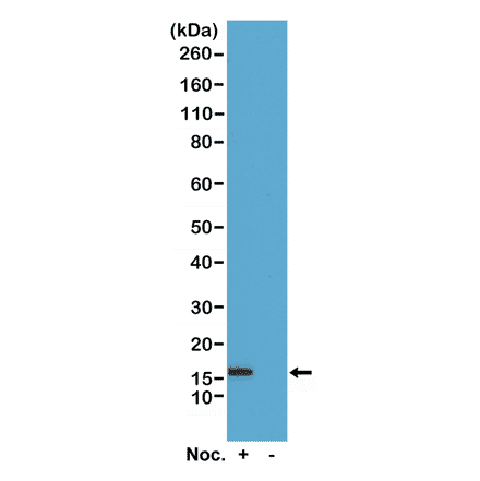 Western Blot - Anti-Histone H2B (phospho Ser14) Antibody [RM238] (A121238) - Antibodies.com