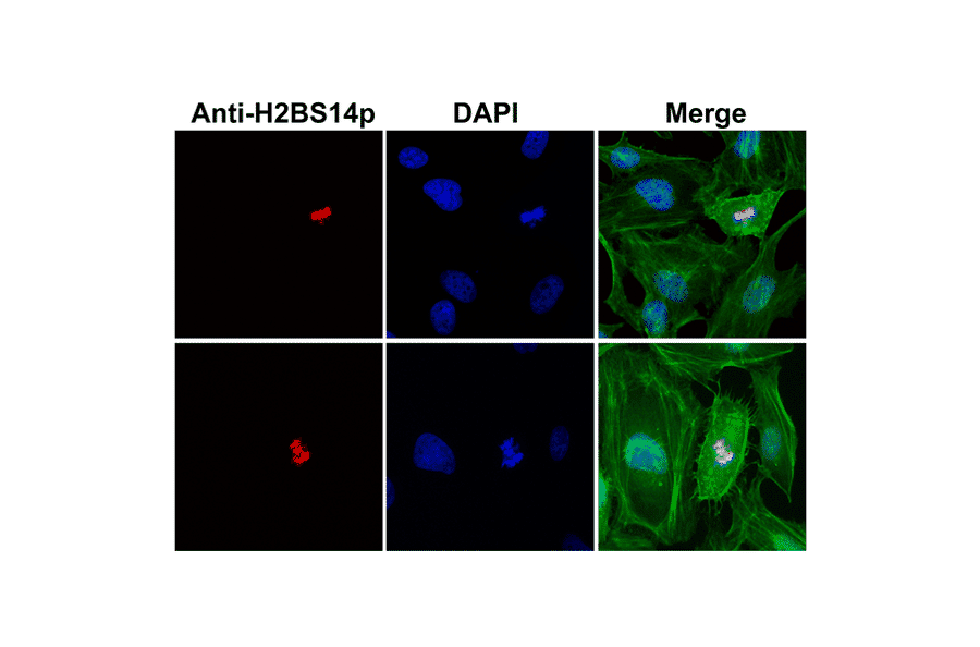 Immunocytochemistry - Anti-Histone H2B (phospho Ser14) Antibody [RM238] (A121240) - Antibodies.com