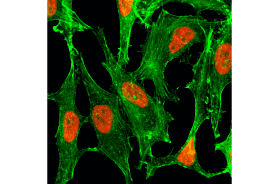 Immunocytochemistry - Anti-Histone H2B (acetyl Lys23) Antibody [RM260] (A121386) - Antibodies.com