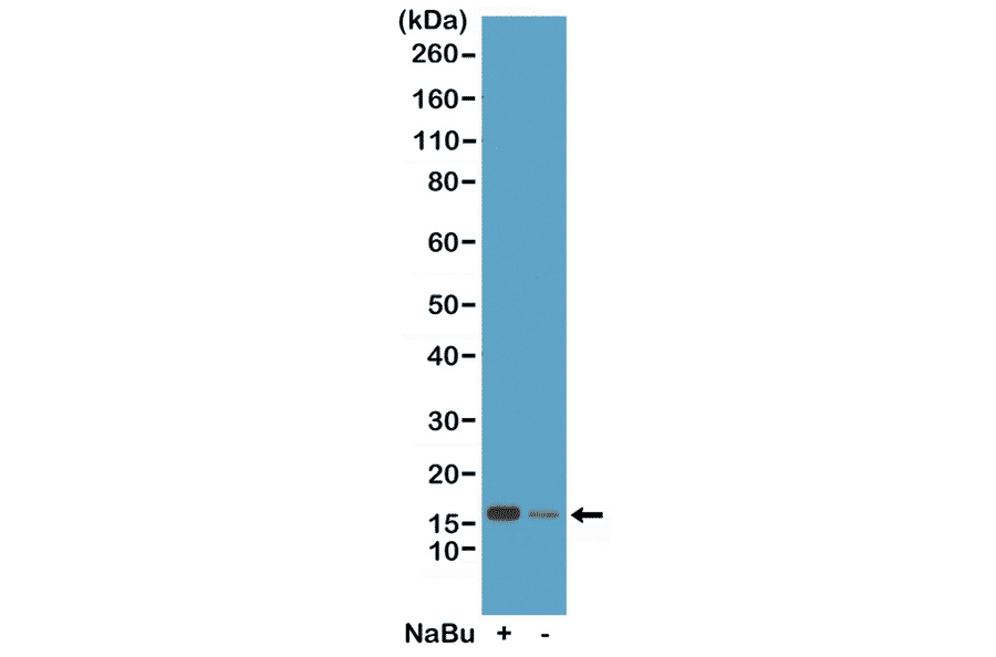 Western Blot - Anti-Histone H2B (acetyl Lys20) Antibody [RM235] (A121240) - Antibodies.com
