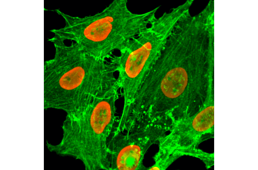 Immunocytochemistry - Anti-Histone H2B (acetyl Lys20) Antibody [RM235] (A121315) - Antibodies.com