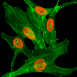 Immunocytochemistry - Anti-Histone H2A.Z (acetyl Lys4) Antibody [RM221] (A121273) - Antibodies.com