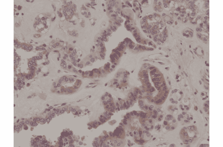 Immunohistochemistry - Anti-EIF 2 alpha (phospho Ser51) Antibody [RM298] (A121245) - Antibodies.com
