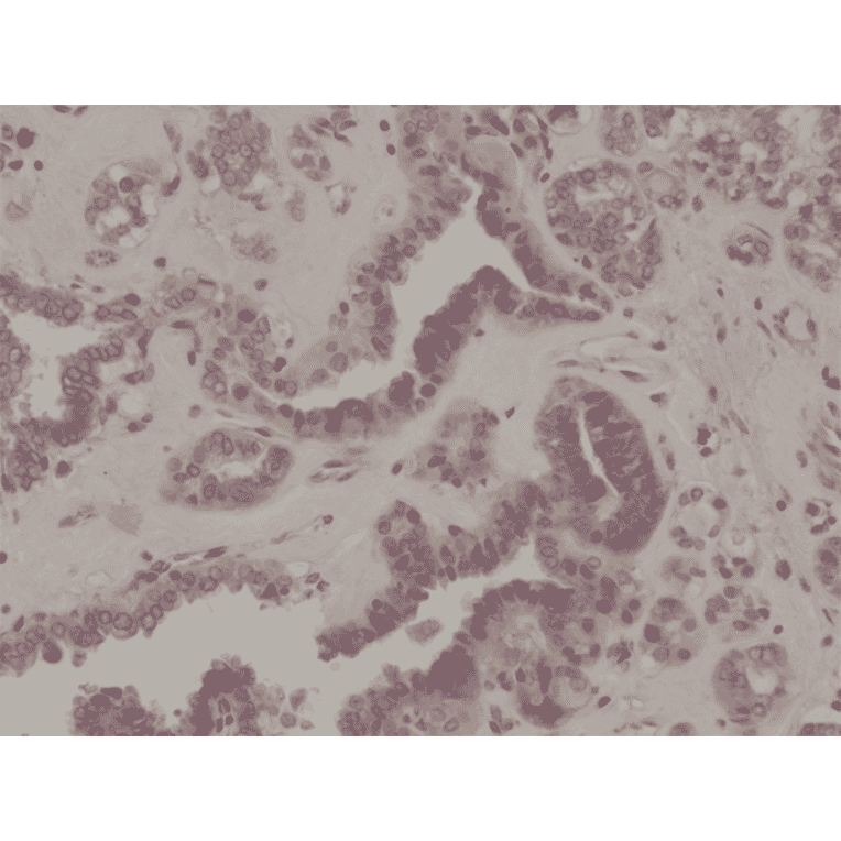 Immunohistochemistry - Anti-EIF 2 alpha (phospho Ser51) Antibody [RM298] (A121245) - Antibodies.com