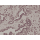 Immunohistochemistry - Anti-EIF 2 alpha (phospho Ser51) Antibody [RM298] (A121245) - Antibodies.com