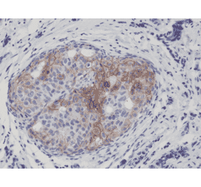 Immunohistochemistry - Anti-EGFR (phospho Tyr1173) Antibody [RM269] (A121410) - Antibodies.com