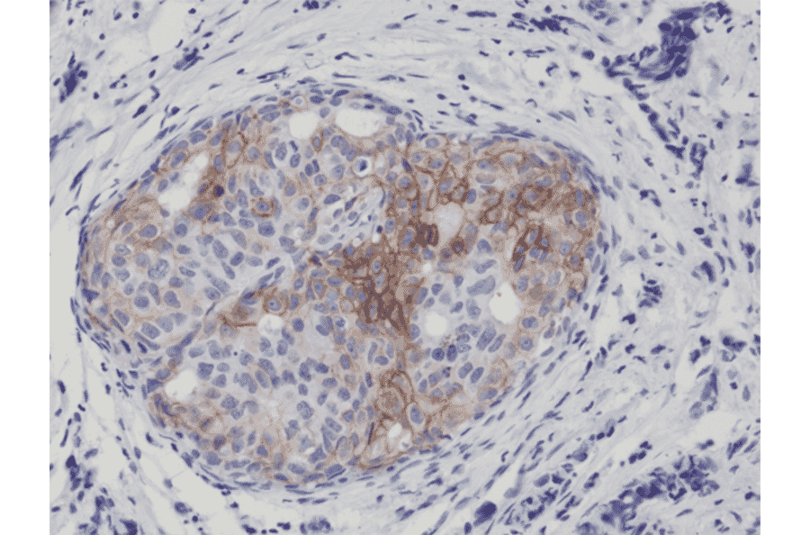 Immunohistochemistry - Anti-EGFR (phospho Tyr1173) Antibody [RM269] (A121410) - Antibodies.com